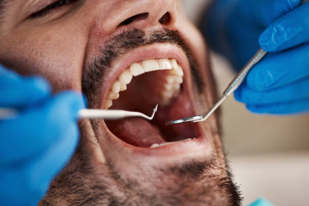 Best Urgent Tooth Repair  in Iola, KS
