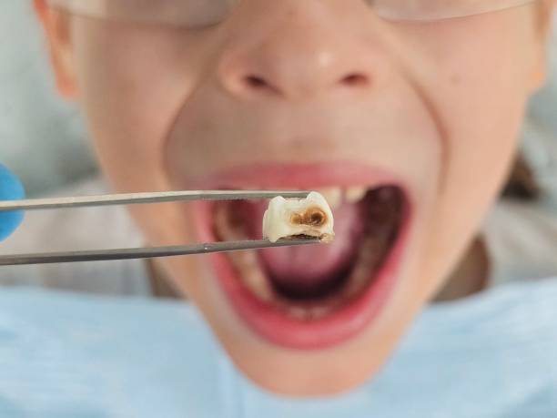 Best Urgent Dental Care  in Iola, KS