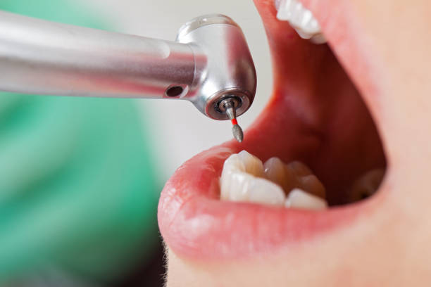 Best Emergency Gum Pain Relief  in Iola, KS